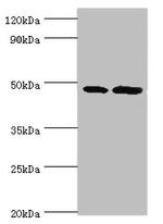 AP1M2 Antibody in Western Blot (WB)