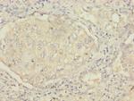 MSRB2 Polyclonal Antibody