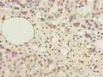 PPP2R3B Polyclonal Antibody