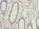NFS1 Polyclonal Antibody