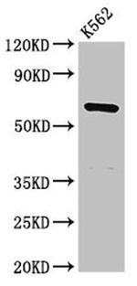 CDYL Antibody in Western Blot (WB)