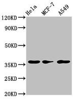 RCE1 Polyclonal Antibody