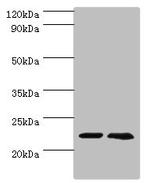 ASF1A Polyclonal Antibody