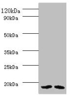 PAM16 Polyclonal Antibody