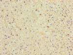 MMACHC Polyclonal Antibody