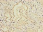 MMACHC Antibody in Immunohistochemistry (Paraffin) (IHC (P))