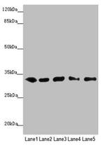 MMACHC Antibody in Western Blot (WB)