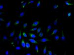 SRPRB Polyclonal Antibody