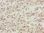 MAGED1 Polyclonal Antibody