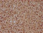 ARL2BP Polyclonal Antibody