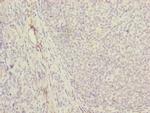 MRPS16 Polyclonal Antibody