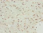 BCS1L Polyclonal Antibody