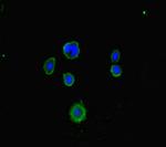 LRCH1 Polyclonal Antibody