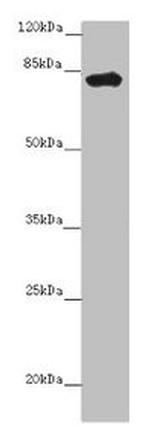 LRCH1 Antibody in Western Blot (WB)