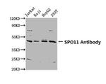 SPO11 Antibody in Western Blot (WB)