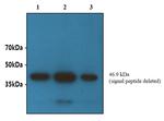 dsCA2b Antibody in Western Blot (WB)
