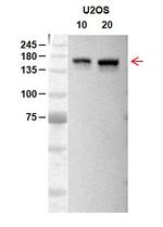 RecQL4 Antibody in Western Blot (WB)