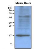 pan Synuclein Antibody in Western Blot (WB)