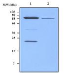MnSOD Antibody in Western Blot (WB)