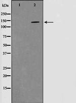 Phospho-PYK2 (Tyr580) Polyclonal Antibody