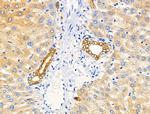 Phospho-EphA2/EphA3/EphA4 (Tyr588, Tyr596) Antibody in Immunohistochemistry (Paraffin) (IHC (P))