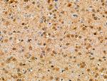 Phospho-C-RAF (Ser301) Antibody in Immunohistochemistry (Paraffin) (IHC (P))