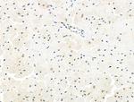 Phospho-C-RAF (Ser301) Antibody in Immunohistochemistry (Paraffin) (IHC (P))