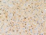 Phospho-C-RAF (Ser301) Antibody in Immunohistochemistry (Paraffin) (IHC (P))