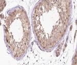Phospho-RARA (Ser77) Antibody in Immunohistochemistry (Paraffin) (IHC (P))