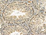 Phospho-FANCG (Ser383) Antibody in Immunohistochemistry (Paraffin) (IHC (P))