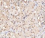 Phospho-PRAK (Thr182) Polyclonal Antibody