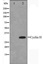 Cyclin H Antibody in Western Blot (WB)