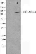 EphA2/EphA3/EphA4 Polyclonal Antibody