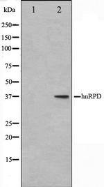 hnRNP D Antibody in Western Blot (WB)