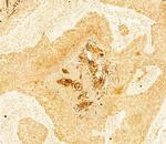 Collagen II Polyclonal Antibody