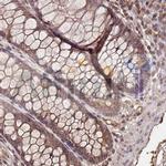 Collagen II Antibody in Immunohistochemistry (Paraffin) (IHC (P))