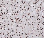Cyclin A Antibody in Immunohistochemistry (Paraffin) (IHC (P))