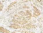 Cyclin A Antibody in Immunohistochemistry (Paraffin) (IHC (P))