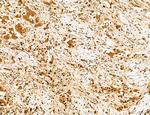 Cyclin A Antibody in Immunohistochemistry (Paraffin) (IHC (P))
