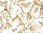 Cyclin A Antibody in Immunohistochemistry (Paraffin) (IHC (P))
