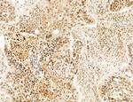 Cyclin A Antibody in Immunohistochemistry (Paraffin) (IHC (P))