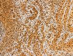 Cyclin A Antibody in Immunohistochemistry (Paraffin) (IHC (P))
