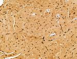 Cyclin A Antibody in Immunohistochemistry (Paraffin) (IHC (P))