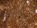 Cyclin A Antibody in Immunohistochemistry (Paraffin) (IHC (P))