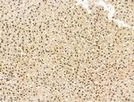 Cyclin A Antibody in Immunohistochemistry (Paraffin) (IHC (P))