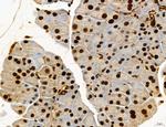 Cyclin A Antibody in Immunohistochemistry (Paraffin) (IHC (P))