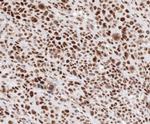 Cyclin G1 Antibody in Immunohistochemistry (Paraffin) (IHC (P))
