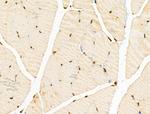 E2F4 Antibody in Immunohistochemistry (Paraffin) (IHC (P))