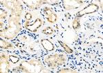 FGFR1OP Polyclonal Antibody
