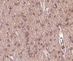 mGluR2/mGluR3 Polyclonal Antibody